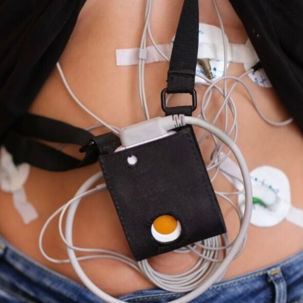 Patient mit angelegtem Langzeit-EKG: Ablauf der Untersuchung und Erkennung von Herzrhythmusstörungen.